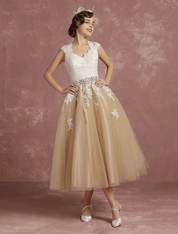 Floor-Length Satin Dress Vintage Wedding Dress Short Champagne Lace Applique Bridal Gown Queen Anne Neck Keyhole Bridal Dress Tea Length Exclusive Floor-Length Satin Dress Vintage Wedding Dress Short Champagne Lace Applique Bridal Gown Queen Anne Neck Keyhole Bridal Dress Tea Length Exclusive